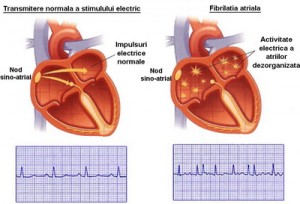 ritmul cardiac
